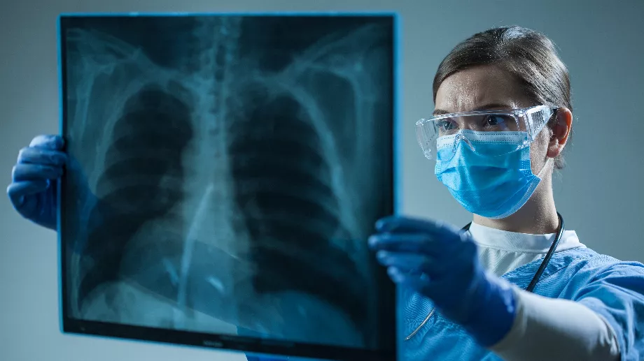 Cette augmentation des cas de tuberculose a touché 40 États et toutes les tranches d’âge aux États-Unis. (Shutterstock)